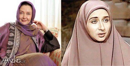 بازیگران زن ایرانی,عکس های بازیگران زن ایرانی,عمل زیبایی بازیگران زن ایرانی