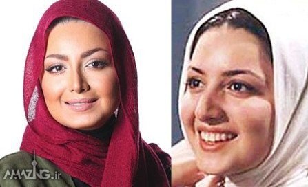 بازیگران زن ایرانی,عکس های بازیگران زن ایرانی,عمل زیبایی بازیگران زن ایرانی
